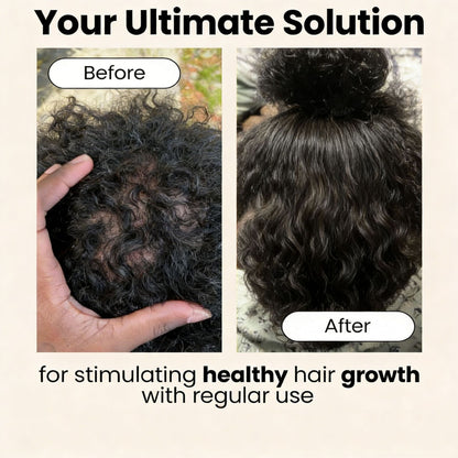 Scalp Stimulator Hair Growth Oil